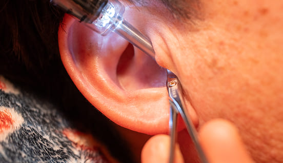 耳毛カットの画像